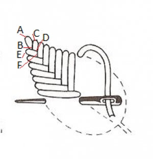 Schematic drawing of the fishbone stitch